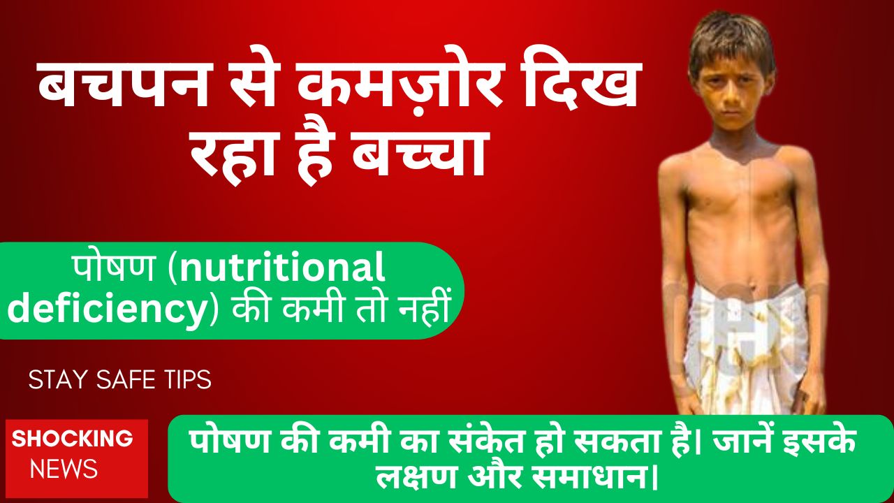बचपन से कमज़ोर दिख रहा है बच्चा कहीं छुपी हुई पोषण (nutritional deficiency) की कमी तो नहीं